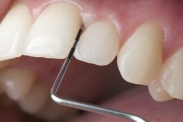 Periodontal Diagnostics